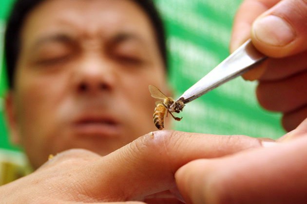 пчелы лечат болезни укус
